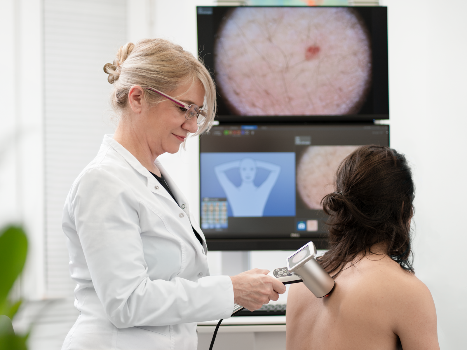 dermatoloski pregledi