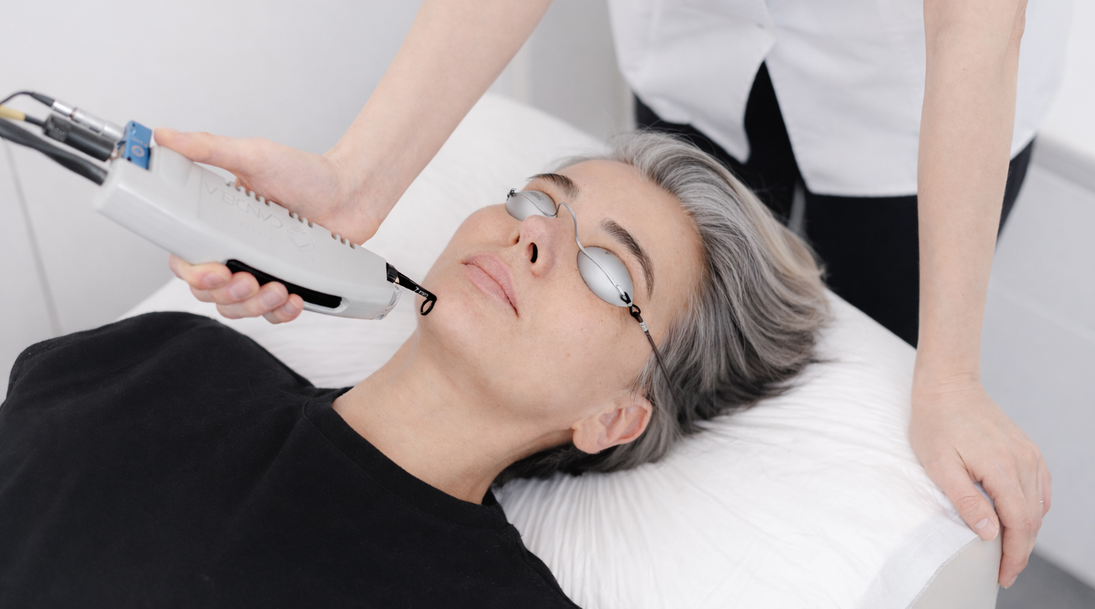 Laserski tretmani beograd dermatim