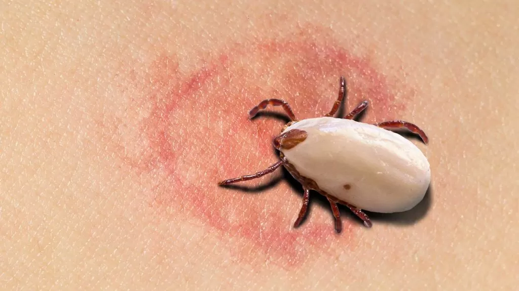 Lyme disease caused by a tick